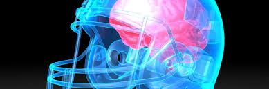 Do helmets reduce risk of concussion?